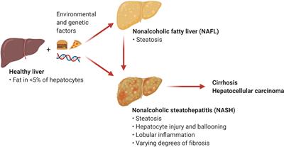 Emerging Roles of T Cells in the Pathogenesis of Nonalcoholic Steatohepatitis and Hepatocellular Carcinoma